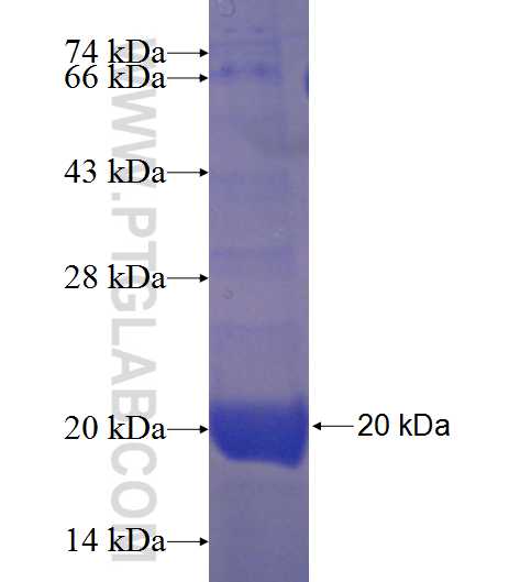 AGBL4 fusion protein Ag22784 SDS-PAGE