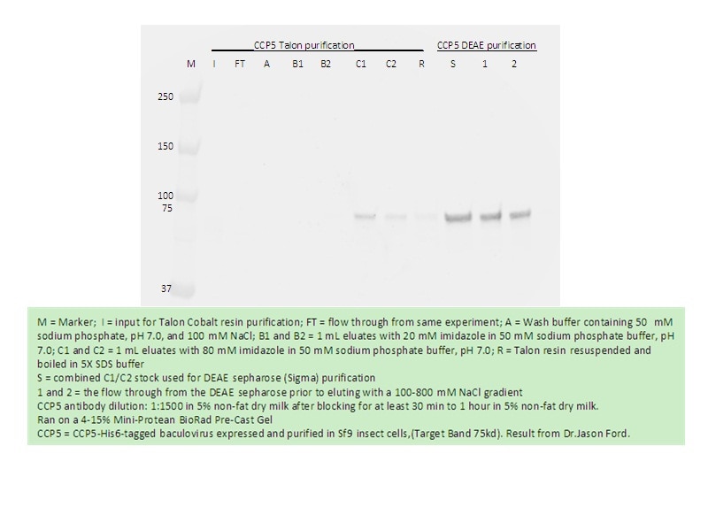 Western Blot (WB) analysis of recombinant protein using AGBL5/CCP5 Polyclonal antibody (15569-1-AP)