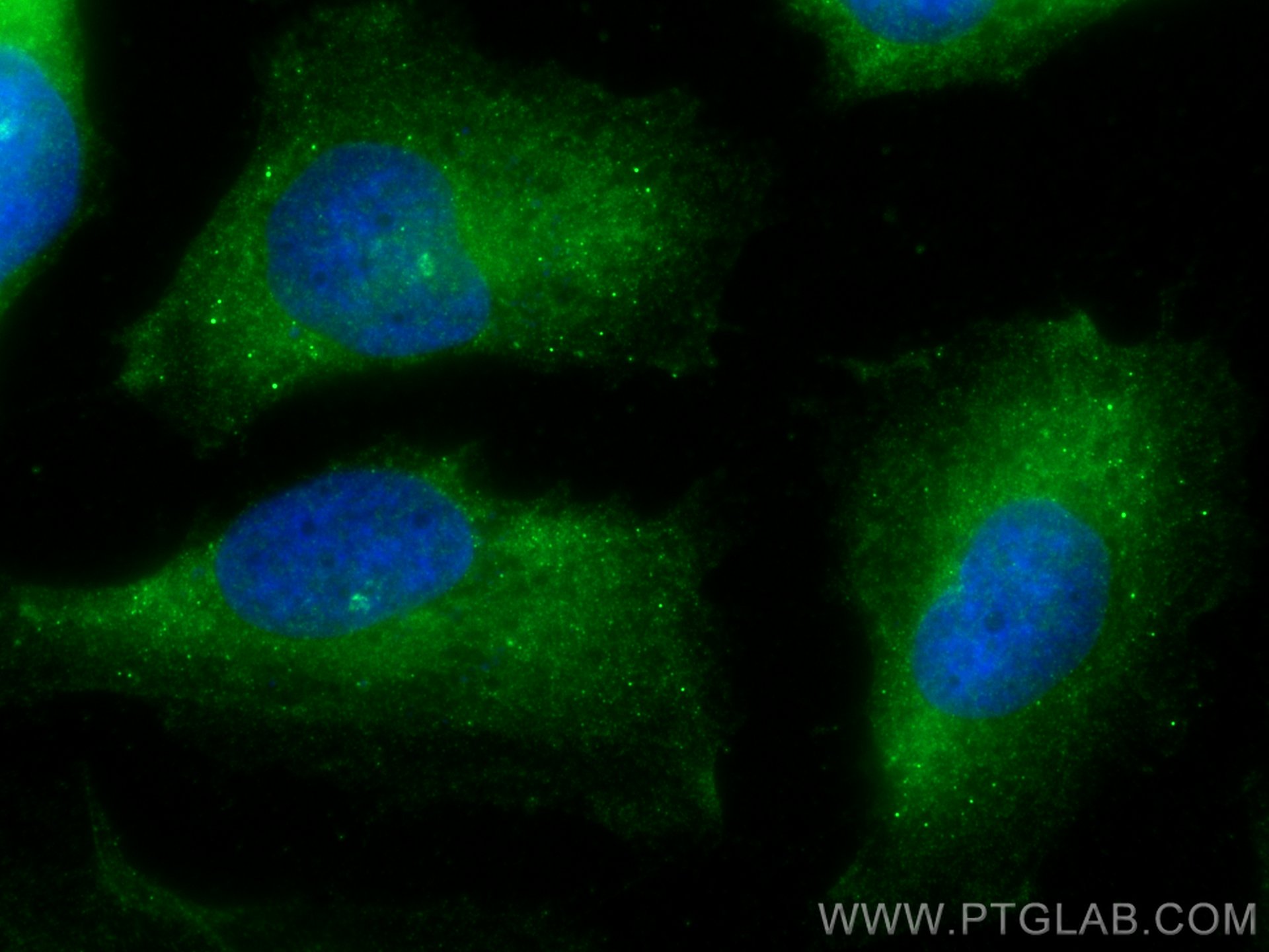 Immunofluorescence (IF) / fluorescent staining of U-251 cells using AGBL5/CCP5 Polyclonal antibody (15569-1-AP)