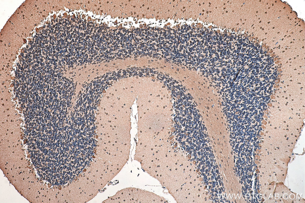 Immunohistochemistry (IHC) staining of mouse cerebellum tissue using AGBL5/CCP5 Polyclonal antibody (15569-1-AP)