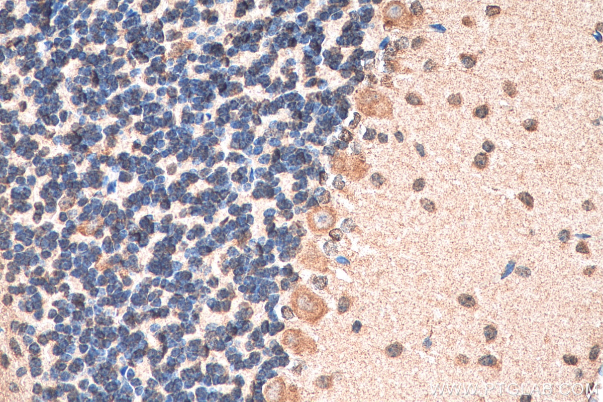 Immunohistochemistry (IHC) staining of mouse cerebellum tissue using AGBL5/CCP5 Polyclonal antibody (15569-1-AP)
