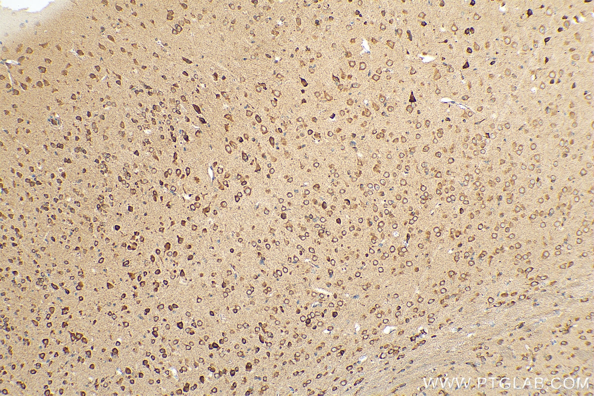 Immunohistochemistry (IHC) staining of mouse brain tissue using AGBL5/CCP5 Polyclonal antibody (15569-1-AP)