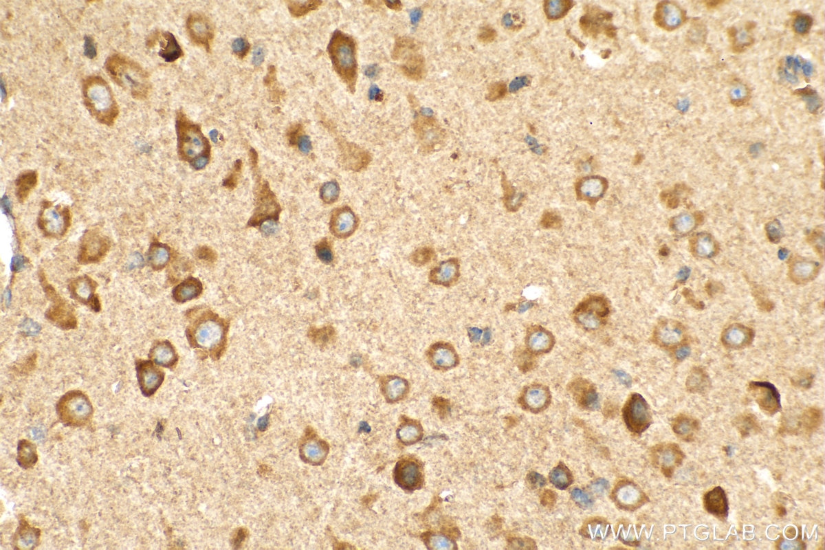 Immunohistochemistry (IHC) staining of mouse brain tissue using AGBL5/CCP5 Polyclonal antibody (15569-1-AP)
