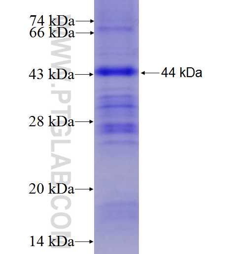 AGBL5 fusion protein Ag7817 SDS-PAGE