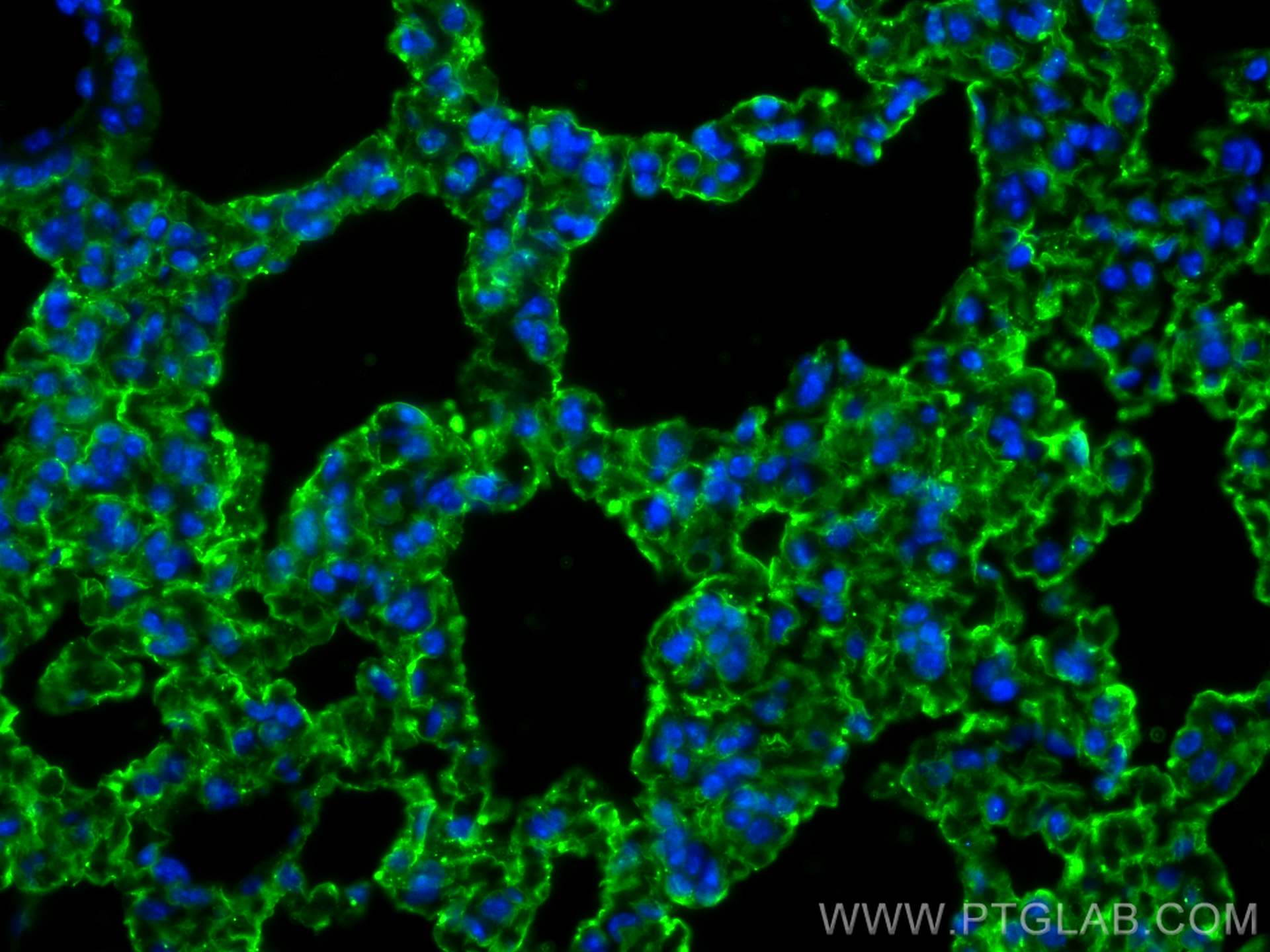Immunofluorescence (IF) / fluorescent staining of mouse lung tissue using AGER Polyclonal antibody (16346-1-AP)
