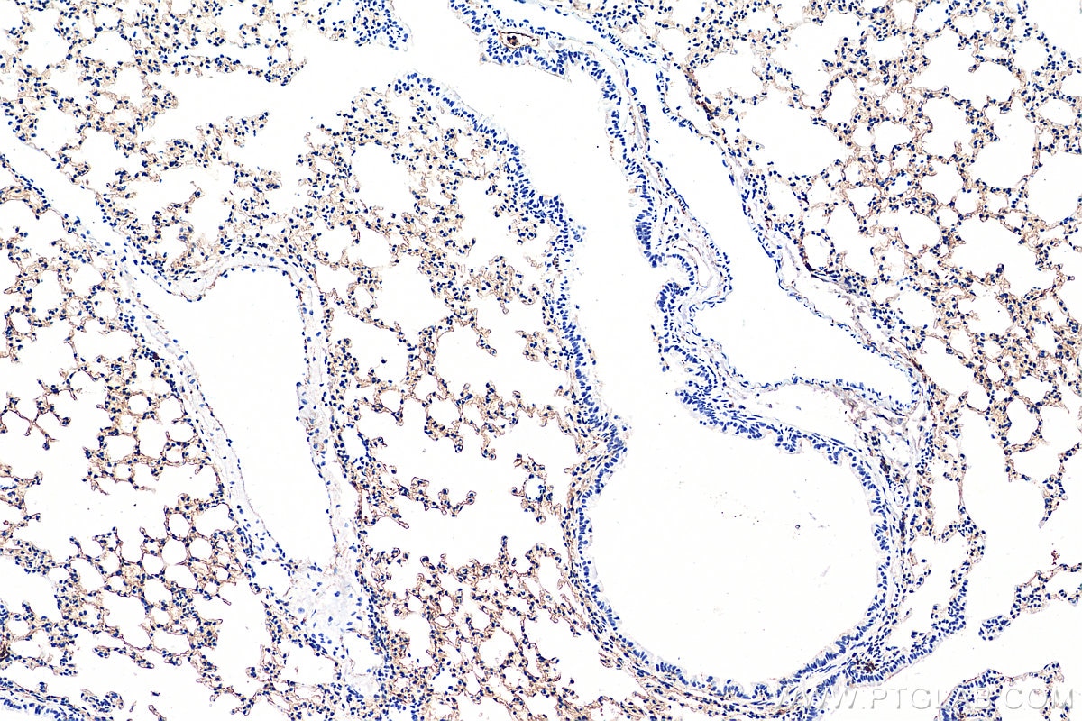 Immunohistochemistry (IHC) staining of mouse lung tissue using AGER Polyclonal antibody (16346-1-AP)