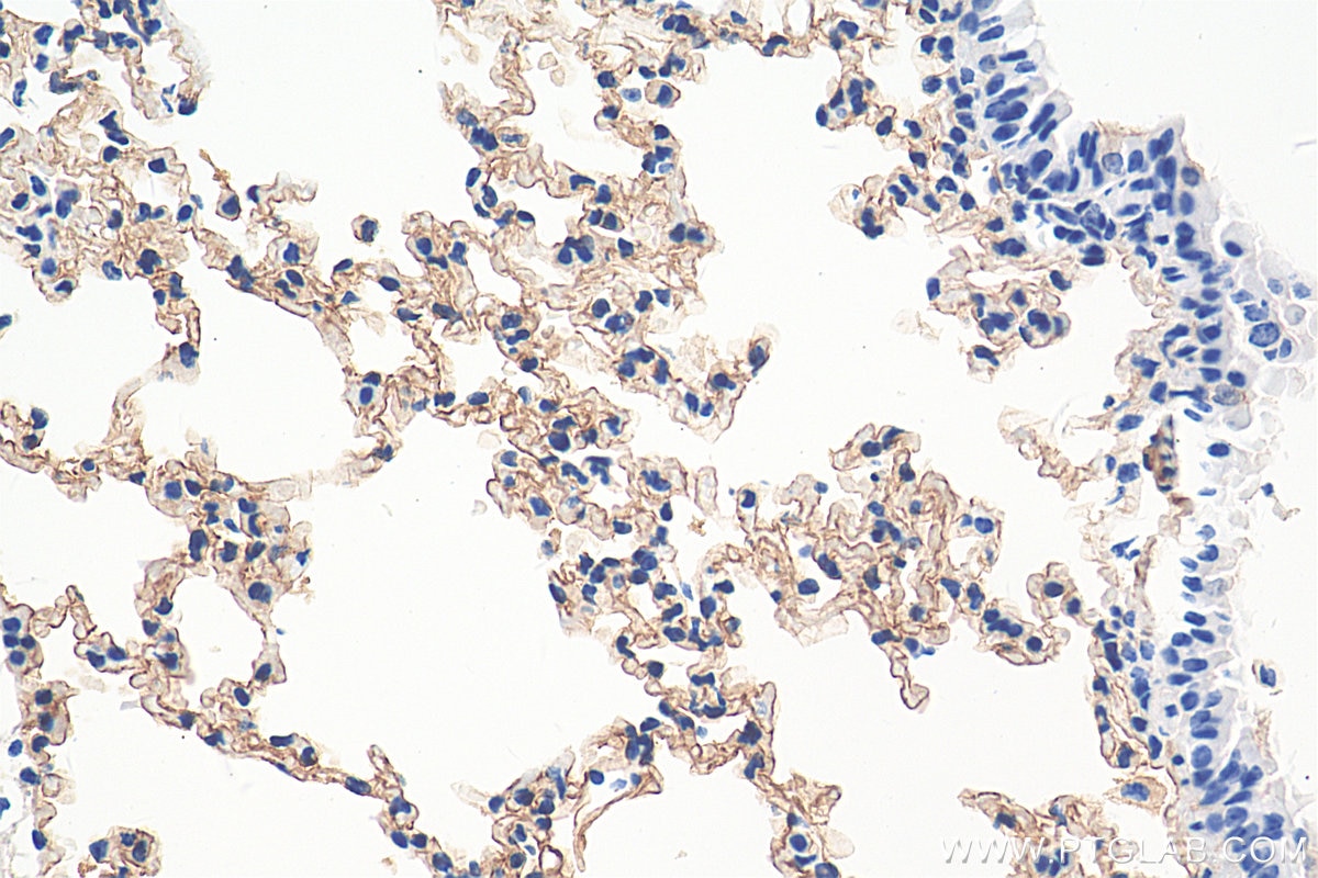 IHC staining of mouse lung using 16346-1-AP