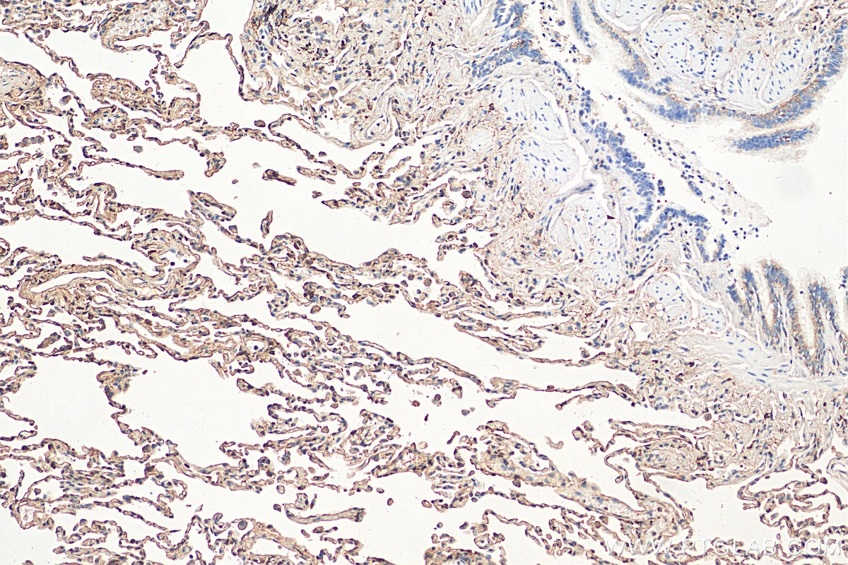 Immunohistochemistry (IHC) staining of human lung tissue using AGER Polyclonal antibody (16346-1-AP)