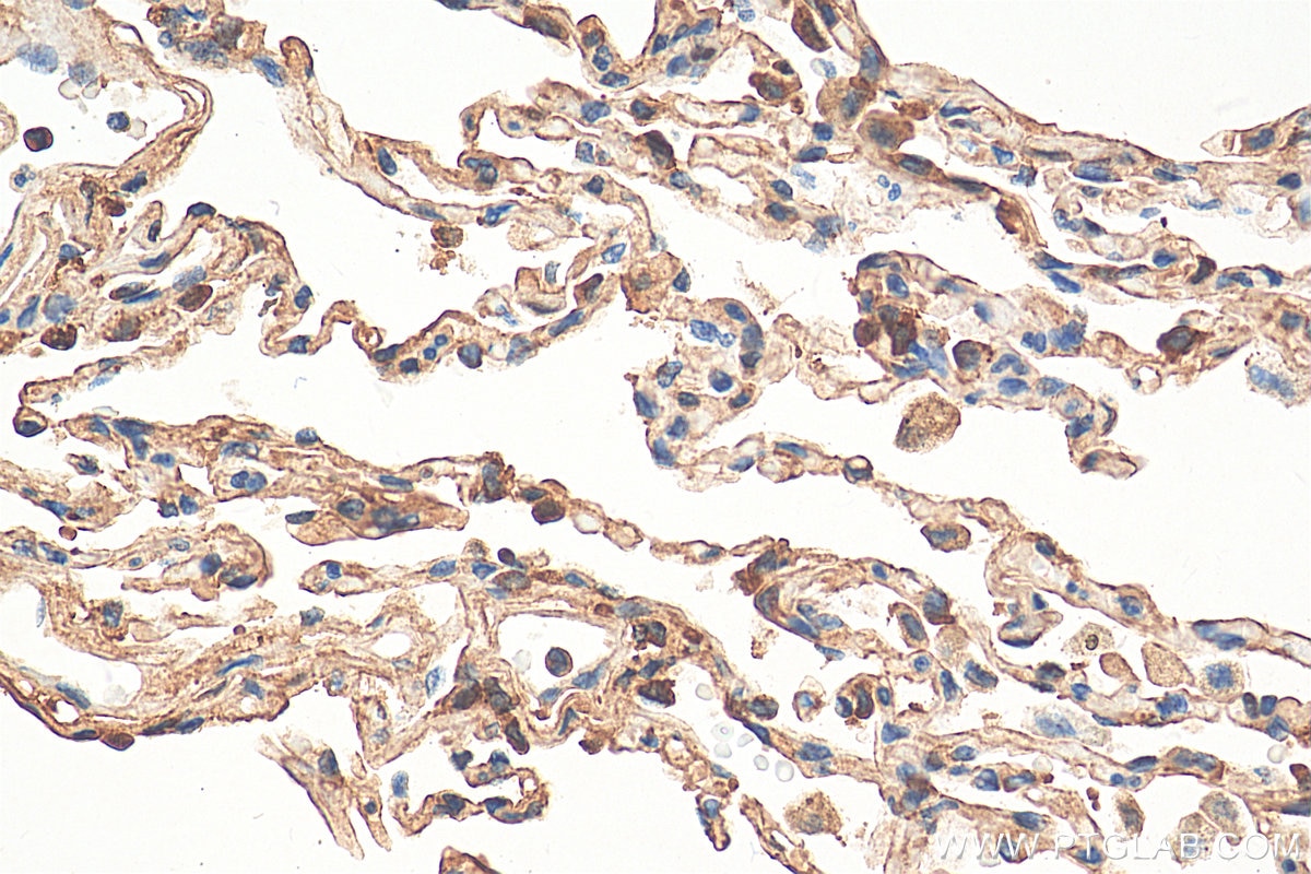 Immunohistochemistry (IHC) staining of human lung tissue using AGER Polyclonal antibody (16346-1-AP)