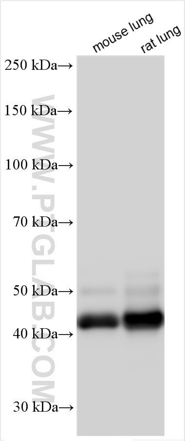 Western Blot (WB) analysis of various lysates using AGER Polyclonal antibody (16346-1-AP)