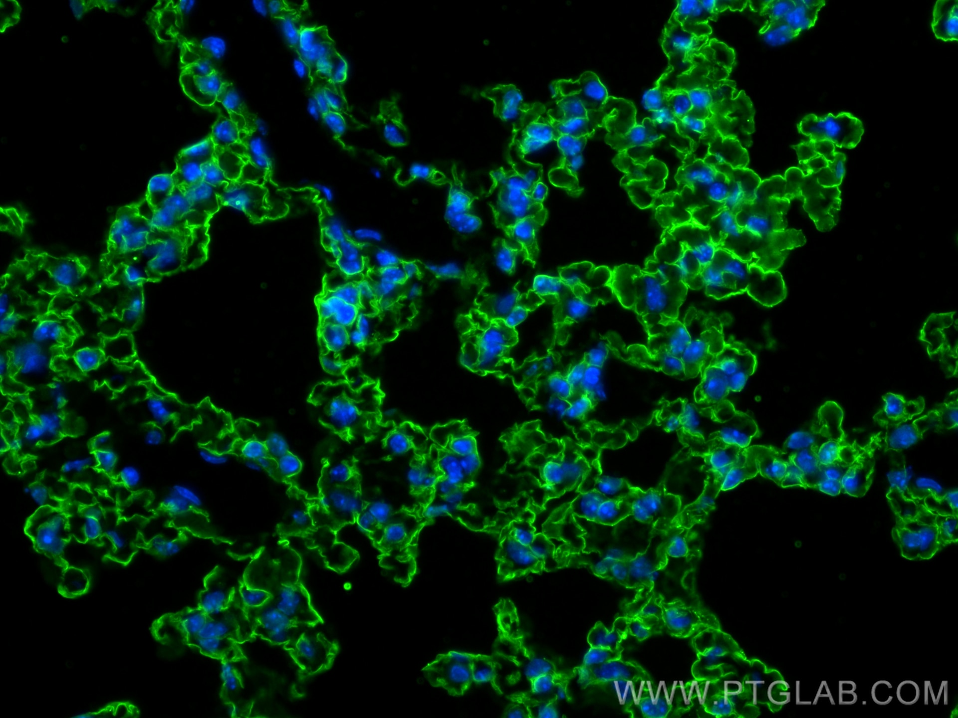 Immunofluorescence (IF) / fluorescent staining of mouse lung tissue using AGER/RAGE Monoclonal antibody (66833-1-Ig)