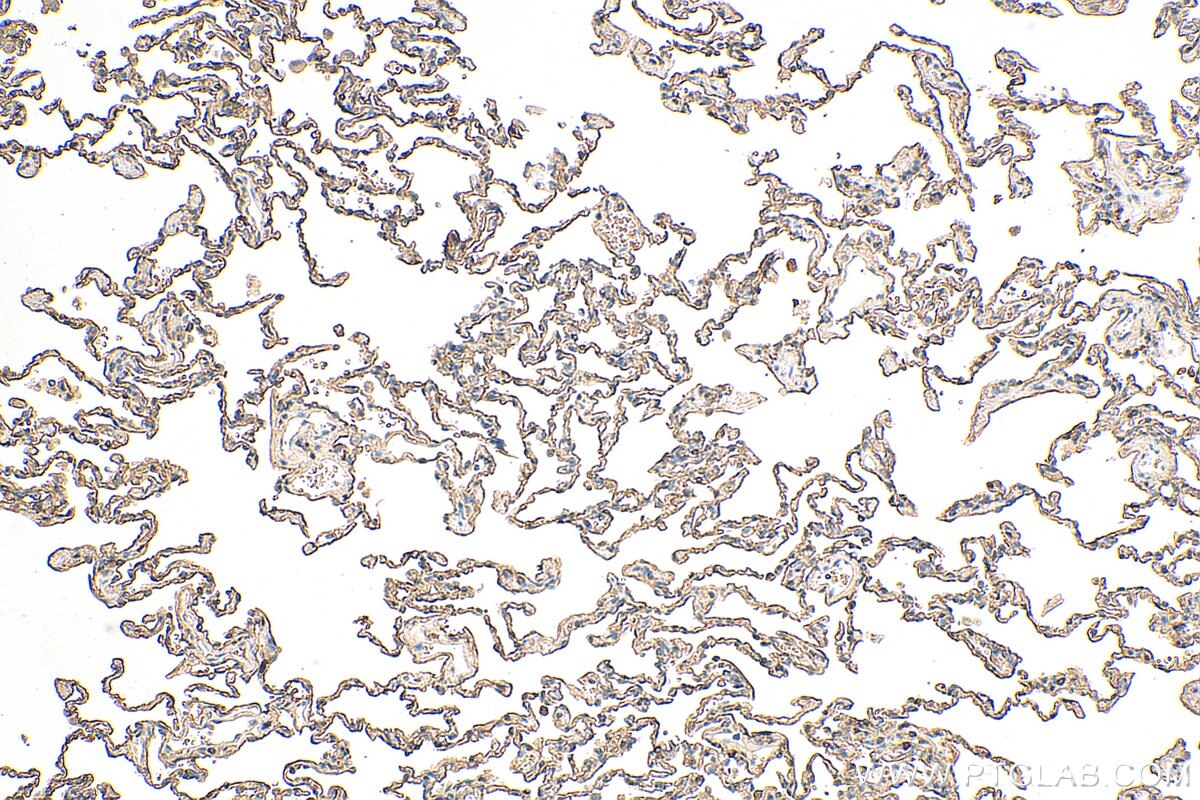 Immunohistochemistry (IHC) staining of human lung tissue using AGER Monoclonal antibody (66833-1-Ig)