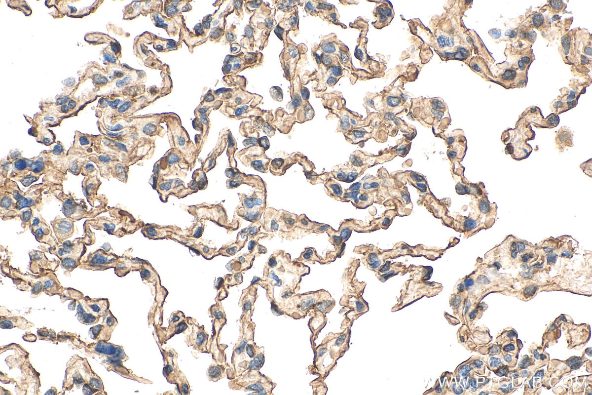 Immunohistochemistry (IHC) staining of human lung tissue using AGER Monoclonal antibody (66833-1-Ig)