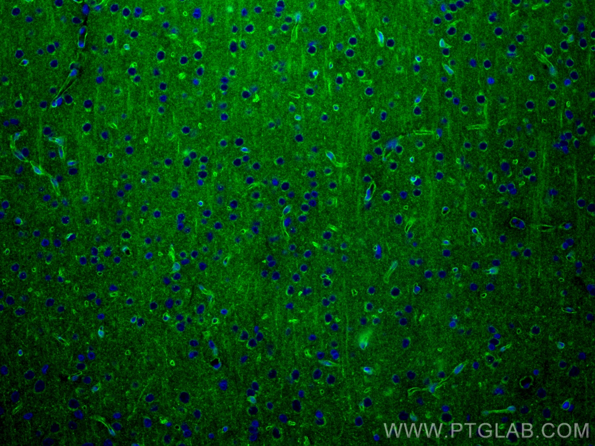 Immunofluorescence (IF) / fluorescent staining of rat brain tissue using AGER Recombinant antibody (83759-4-RR)