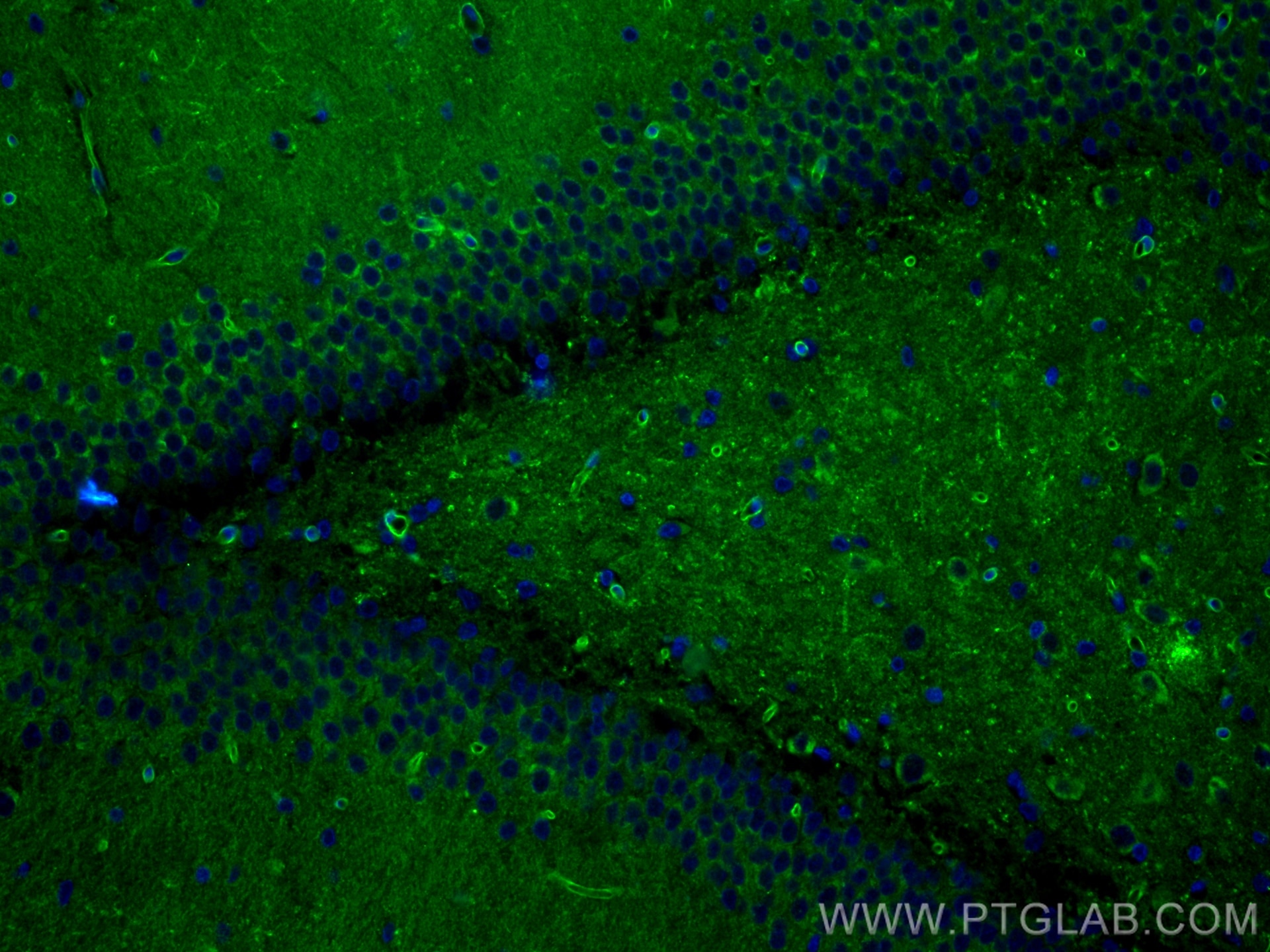 Immunofluorescence (IF) / fluorescent staining of rat brain tissue using AGER Recombinant antibody (83759-4-RR)