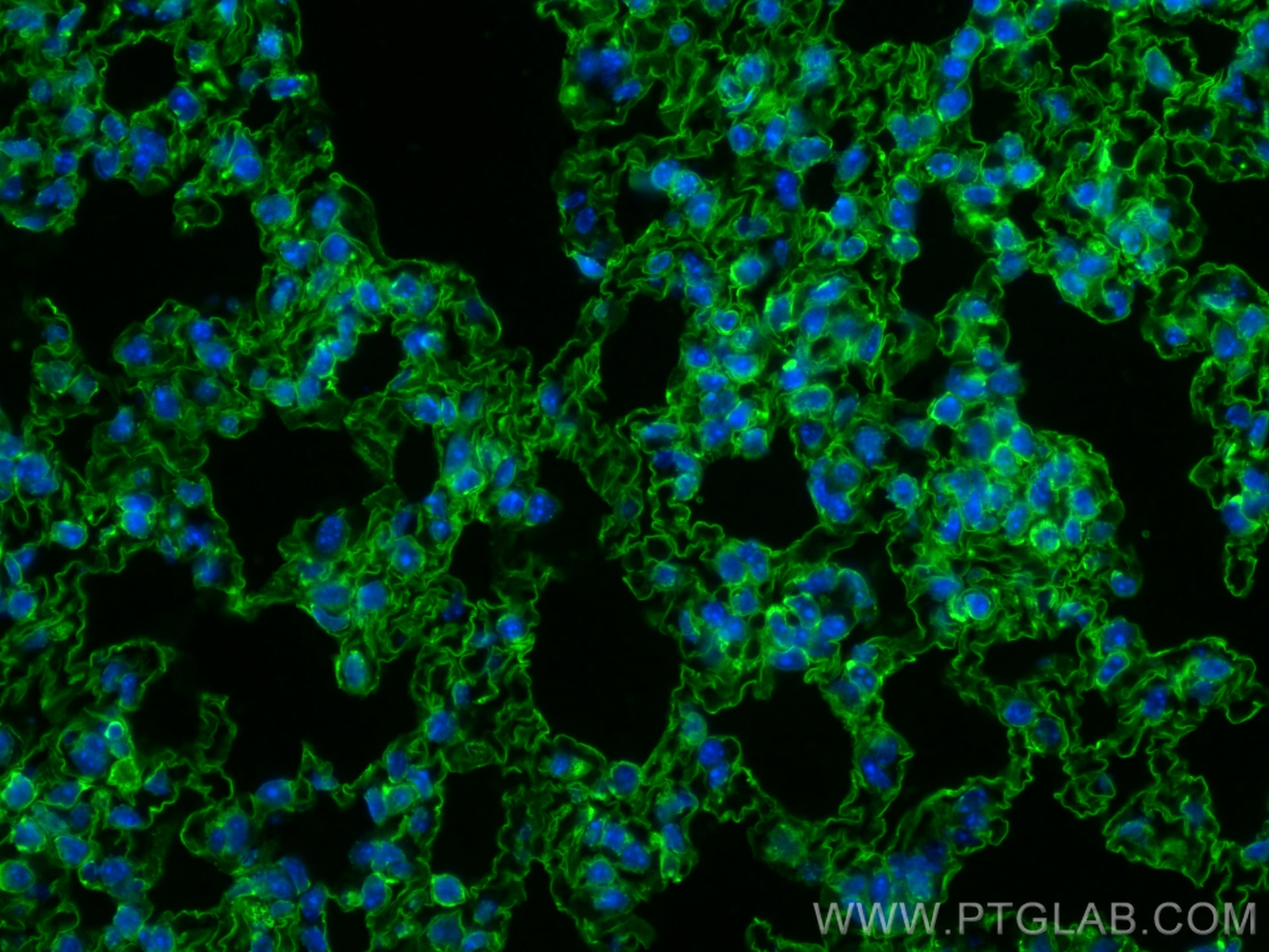 Immunofluorescence (IF) / fluorescent staining of mouse lung tissue using CoraLite® Plus 488-conjugated AGER/RAGE Monoclonal (CL488-66833)