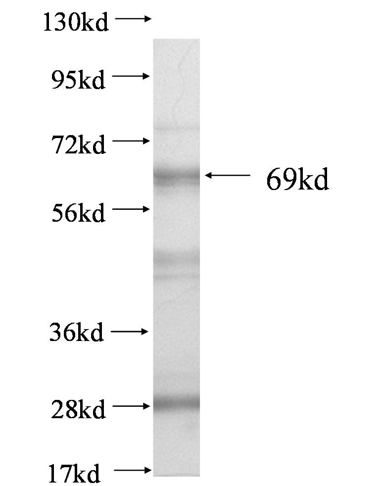 AGER fusion protein Ag0818 SDS-PAGE