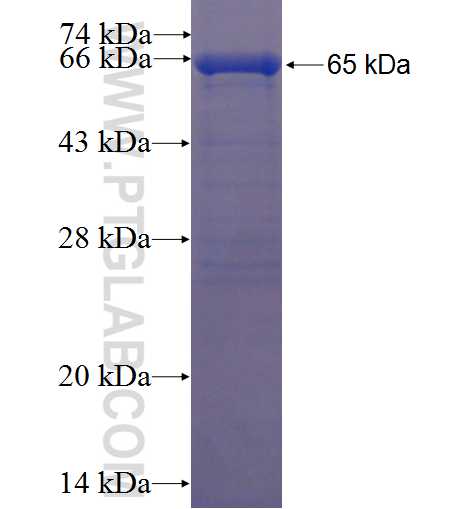 AGER fusion protein Ag9540 SDS-PAGE
