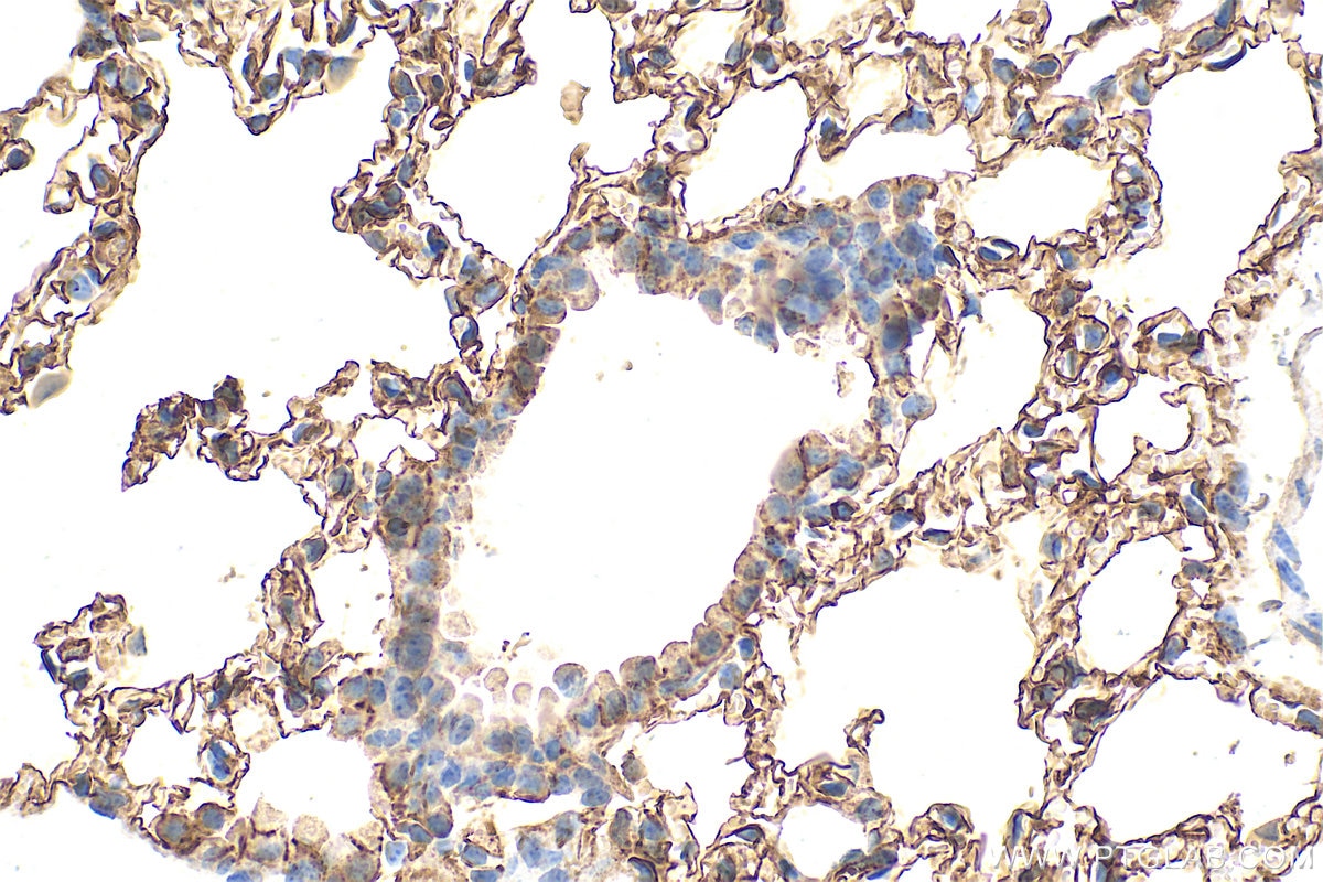 Immunohistochemistry (IHC) staining of mouse lung tissue using AGER/RAGE Polyclonal antibody (32053-1-AP)