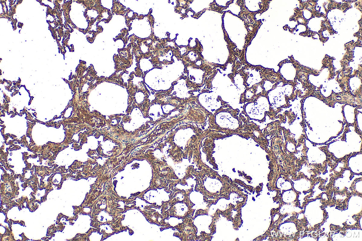 Immunohistochemistry (IHC) staining of rat lung tissue using AGER/RAGE Polyclonal antibody (32053-1-AP)