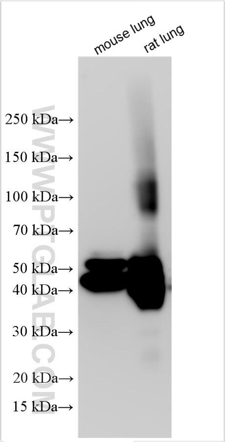 Western Blot (WB) analysis of various lysates using AGER/RAGE Polyclonal antibody (32053-1-AP)