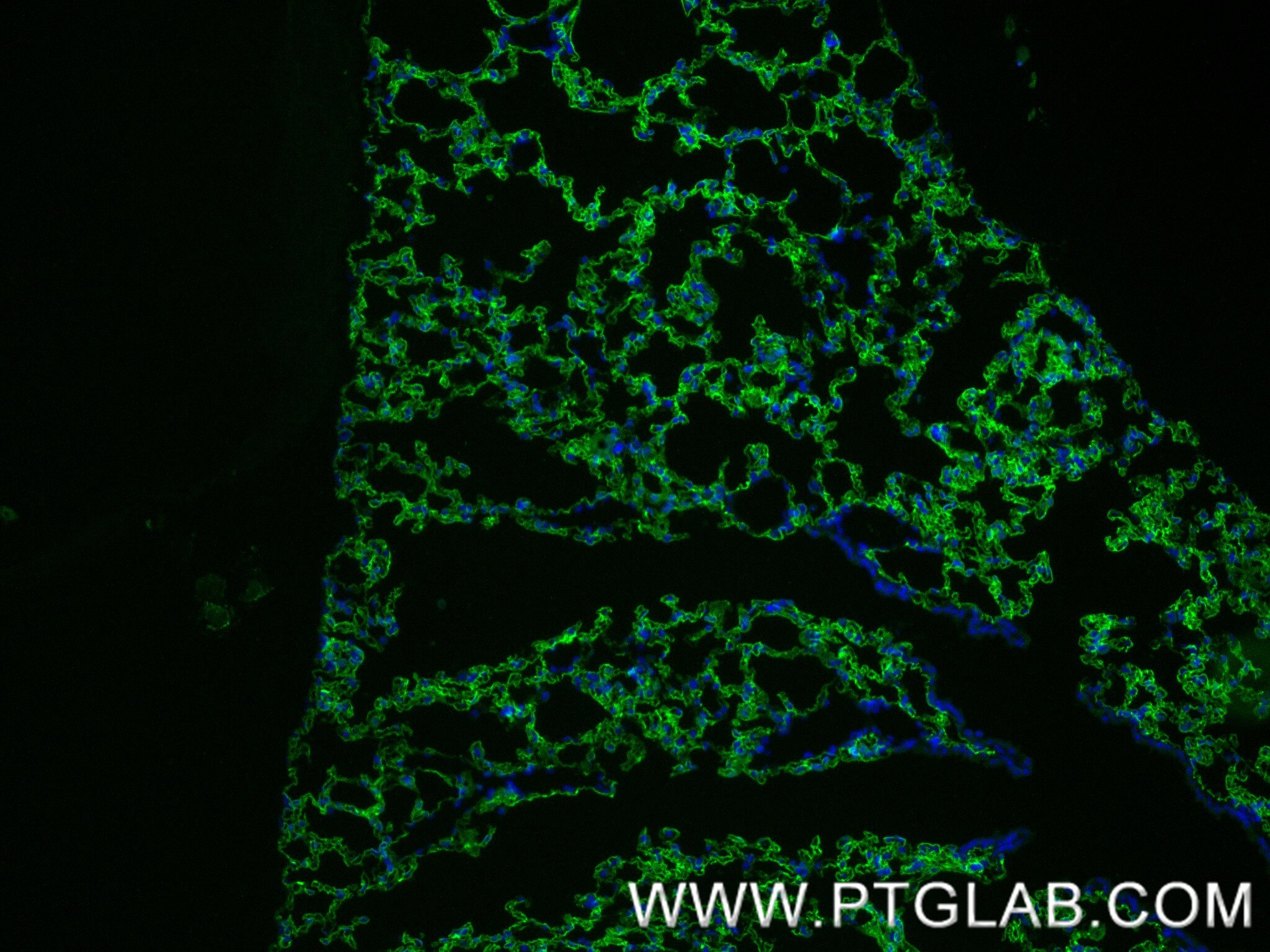 Immunofluorescence (IF) / fluorescent staining of mouse lung tissue using AGER/RAGE Recombinant antibody (83759-5-RR)