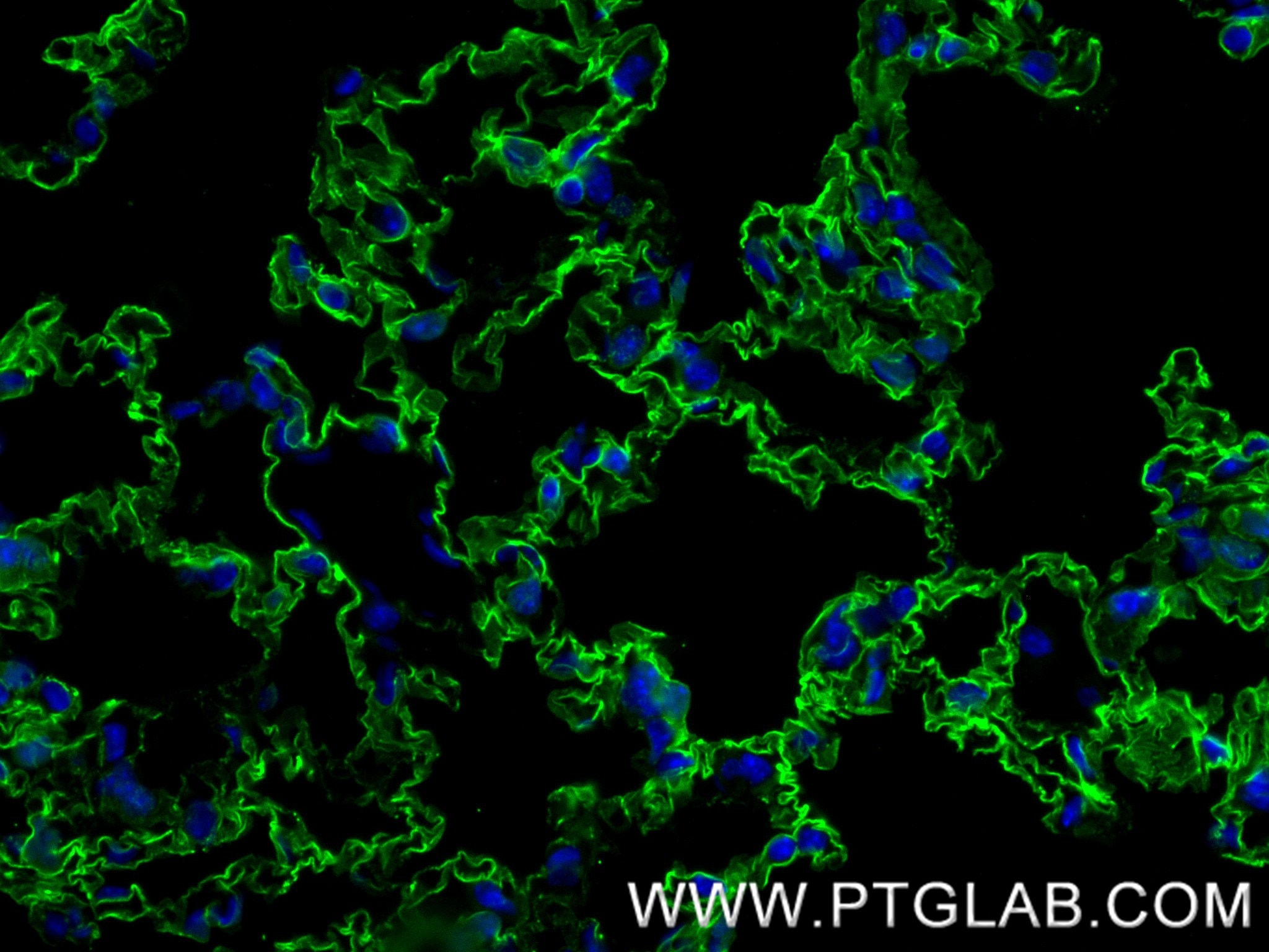 Immunofluorescence (IF) / fluorescent staining of mouse lung tissue using AGER/RAGE Recombinant antibody (83759-5-RR)