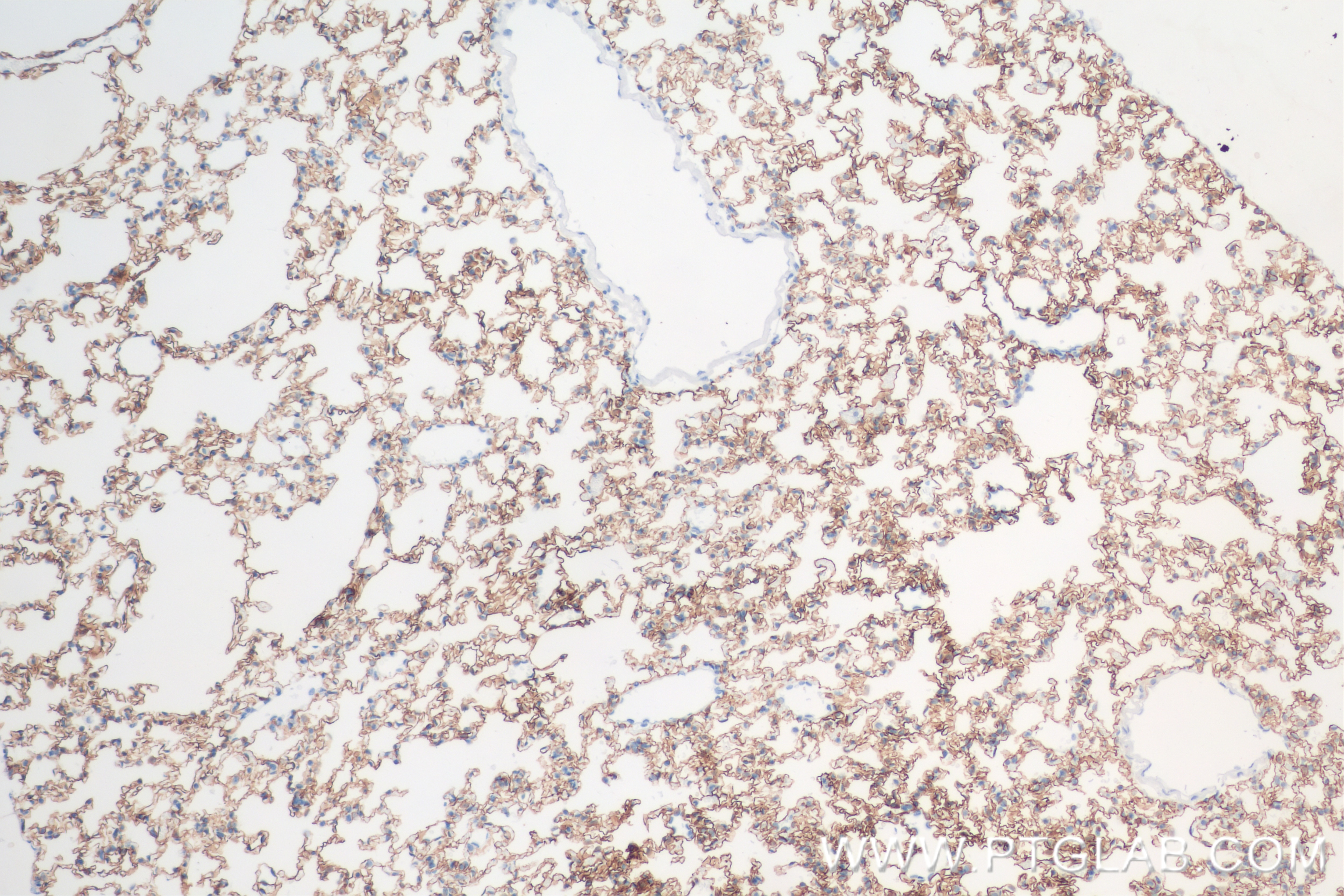 Immunohistochemistry (IHC) staining of rat lung tissue using AGER/RAGE Recombinant antibody (83759-5-RR)