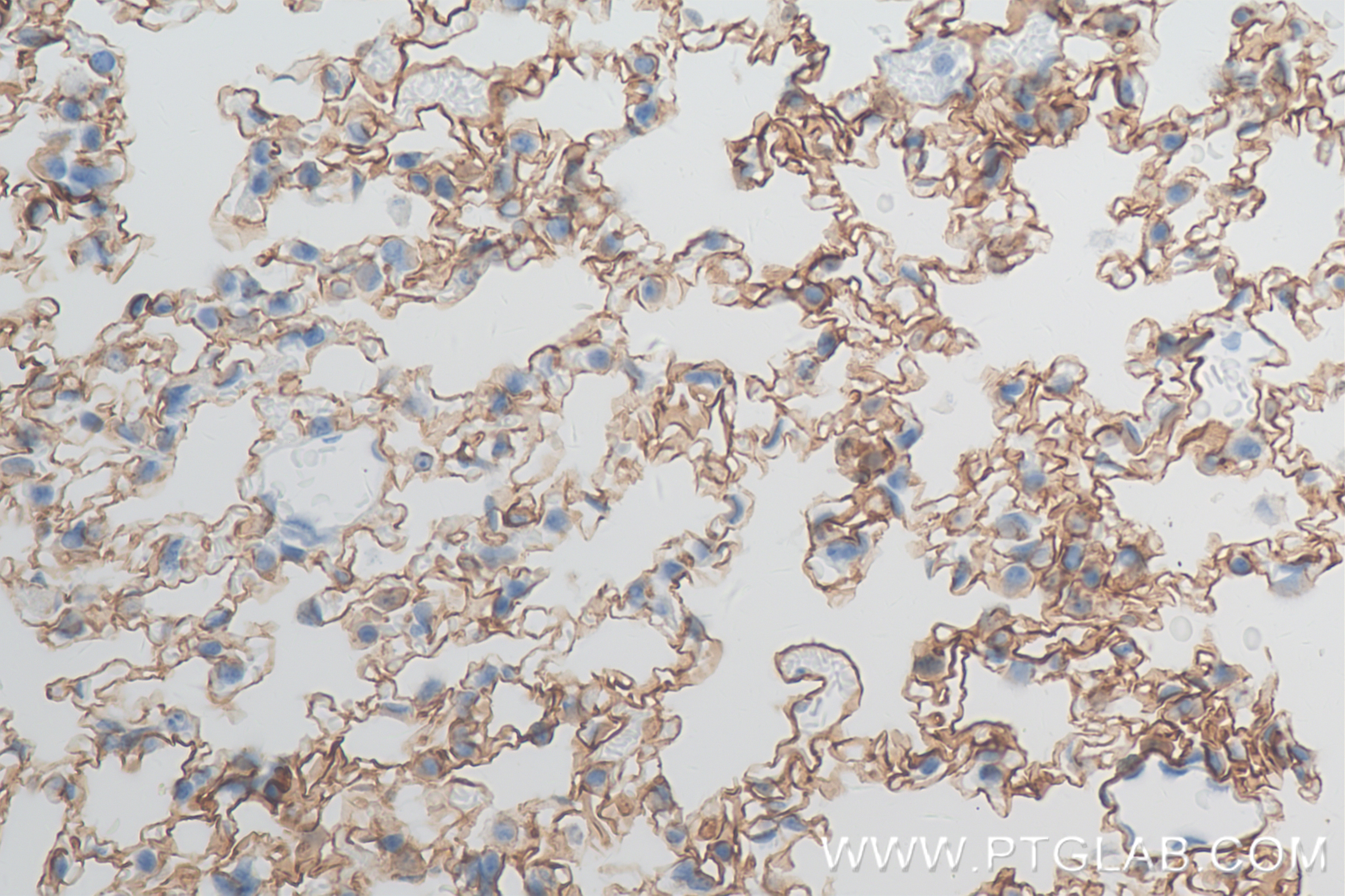 Immunohistochemistry (IHC) staining of rat lung tissue using AGER/RAGE Recombinant antibody (83759-5-RR)