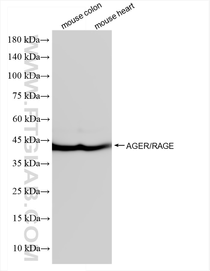 Western Blot (WB) analysis of various lysates using AGER/RAGE Recombinant antibody (83759-5-RR)