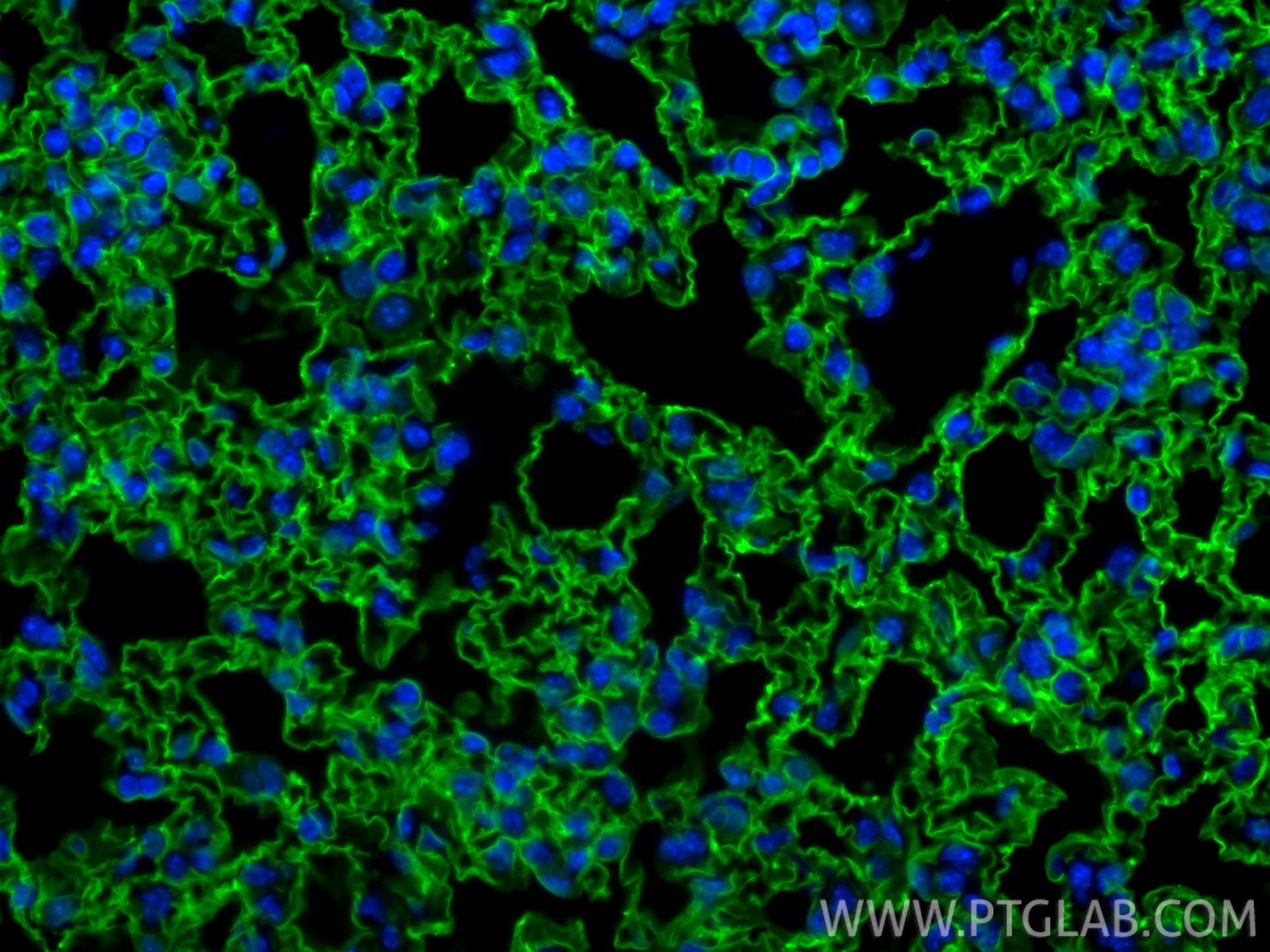 Immunofluorescence (IF) / fluorescent staining of mouse lung tissue using CoraLite® Plus 488-conjugated AGER/RAGE Recombinan (CL488-83759-5)