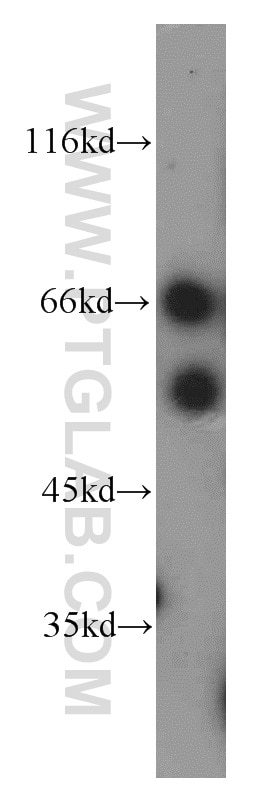 Western Blot (WB) analysis of HeLa cells using AGFG1 Polyclonal antibody (12670-1-AP)