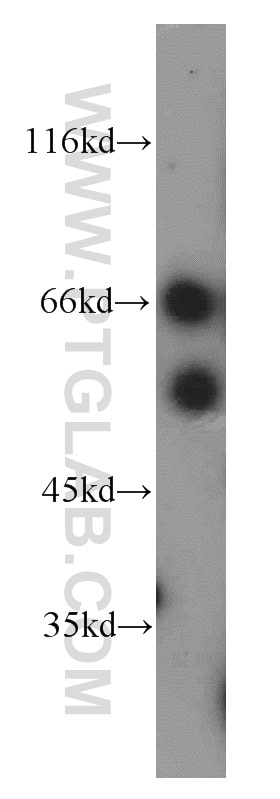 WB analysis of HeLa using 12670-1-AP