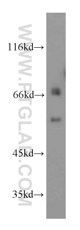 Western Blot (WB) analysis of Jurkat cells using AGFG1 Polyclonal antibody (12670-1-AP)