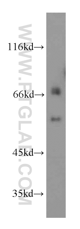 WB analysis of Jurkat using 12670-1-AP