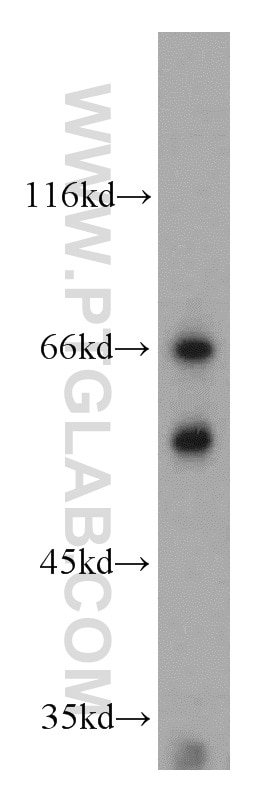 Western Blot (WB) analysis of K-562 cells using AGFG1 Polyclonal antibody (12670-1-AP)