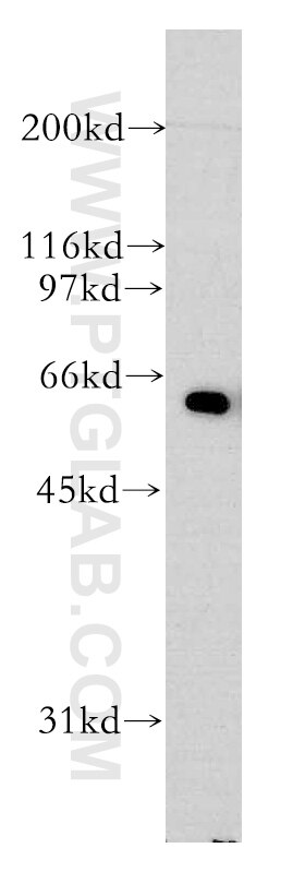 Western Blot (WB) analysis of mouse testis tissue using AGFG1 Polyclonal antibody (12670-1-AP)