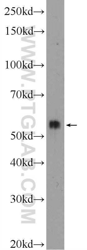 WB analysis of K-562 using 11919-1-AP