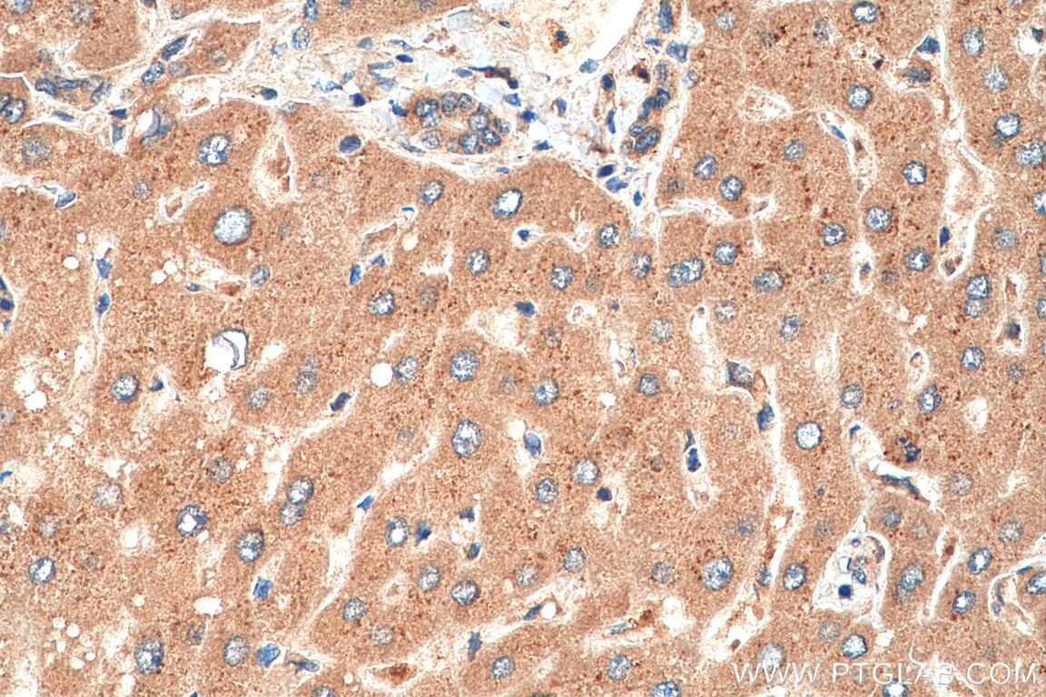 IHC staining of human liver using 11889-1-AP