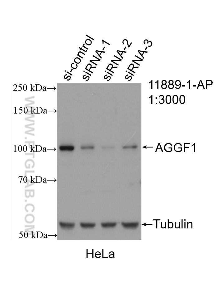 Western Blot (WB) analysis of HeLa cells using AGGF1 Polyclonal antibody (11889-1-AP)
