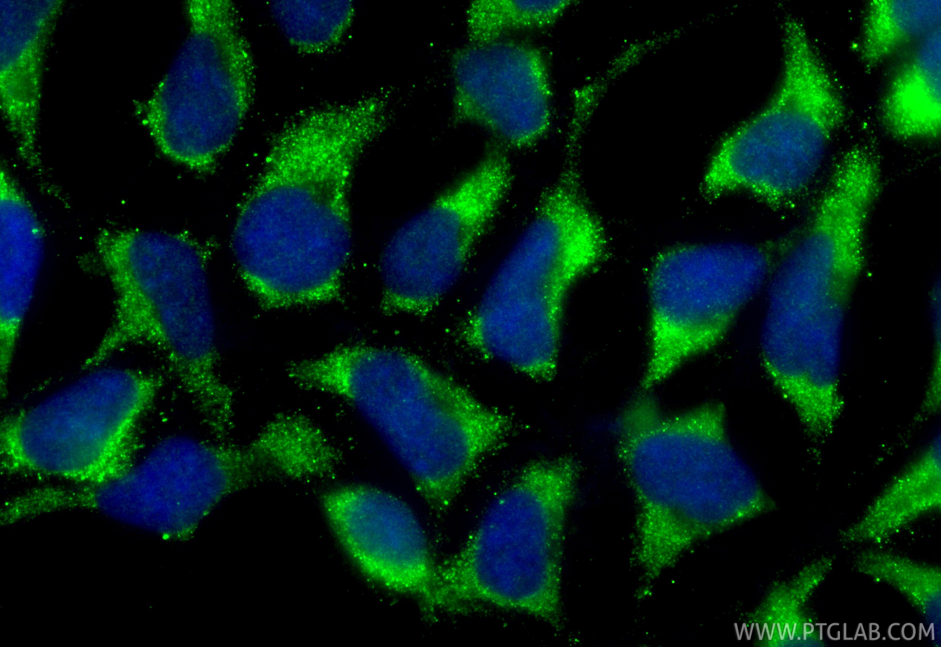 Immunofluorescence (IF) / fluorescent staining of HEK-293 cells using CoraLite® Plus 488-conjugated AGGF1 Recombinant an (CL488-84715-4)