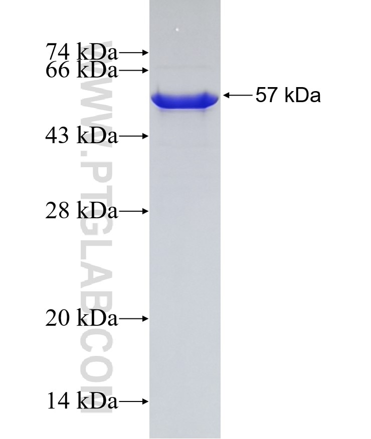 AGGF1 fusion protein Ag2497 SDS-PAGE