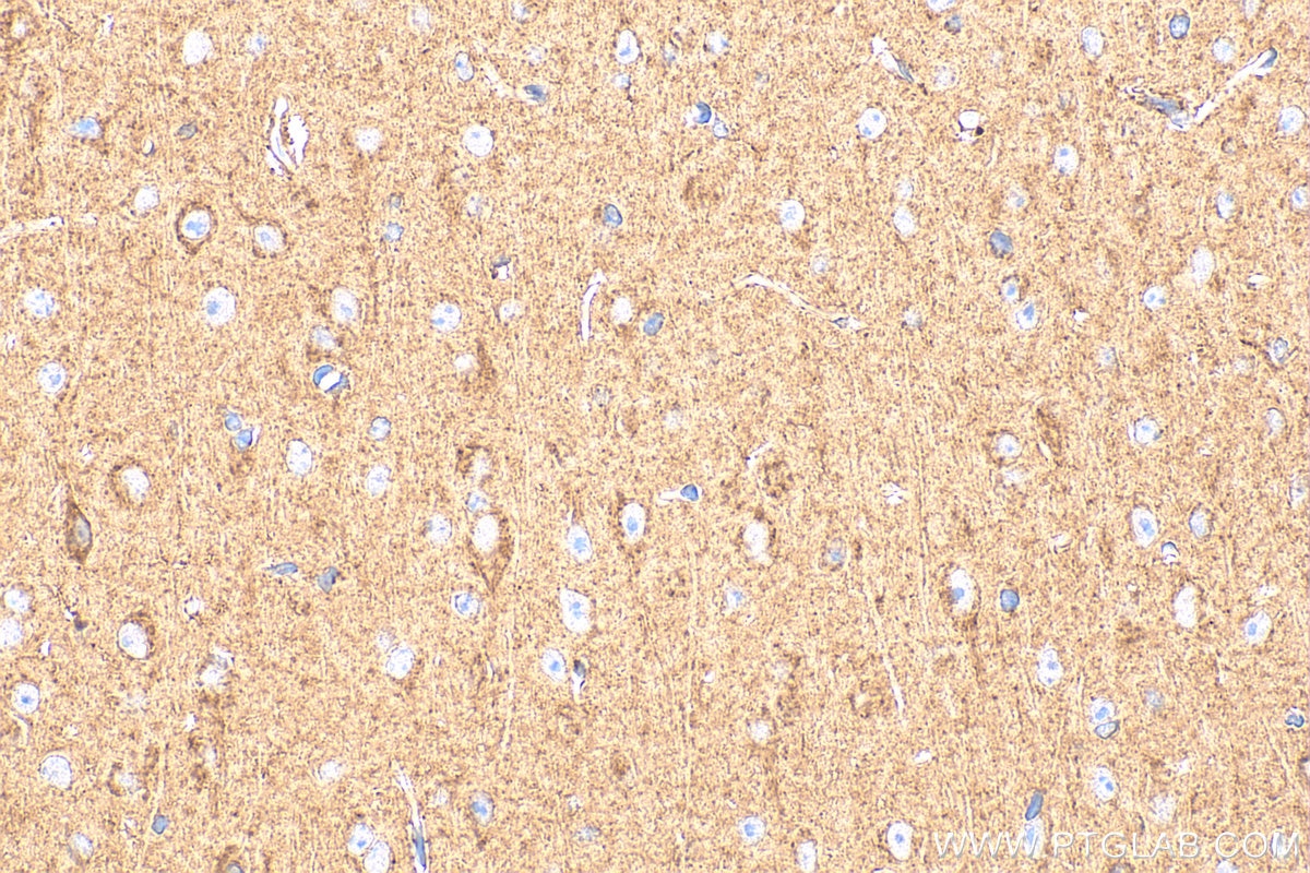 Immunohistochemistry (IHC) staining of mouse brain tissue using AGK Polyclonal antibody (33759-1-AP)