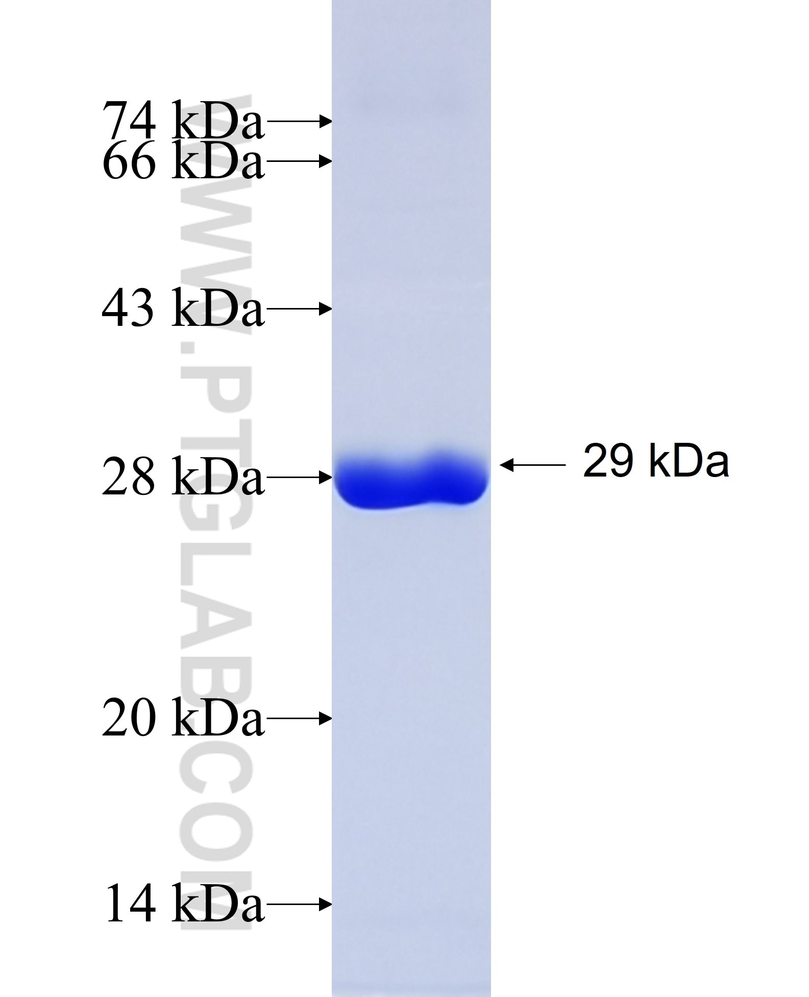 AGK fusion protein Ag34541 SDS-PAGE AGK fusion protein Ag34541 SDS-PAGE