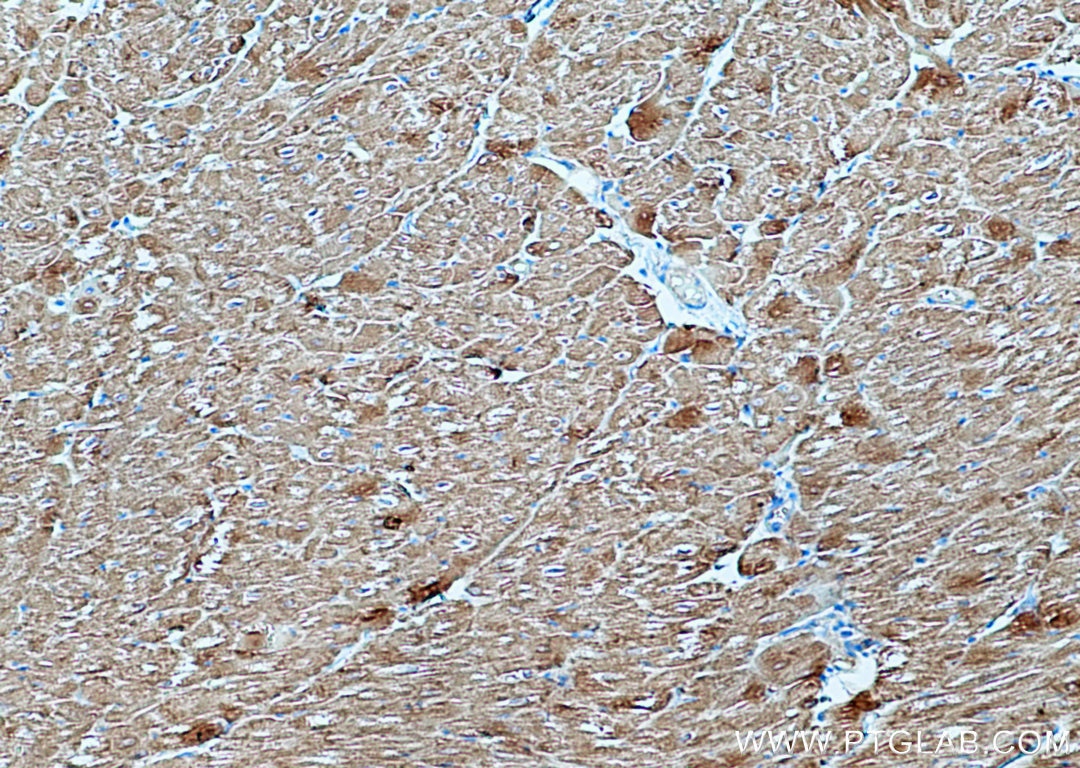 Immunohistochemistry (IHC) staining of human heart tissue using AGL Polyclonal antibody (16582-1-AP)