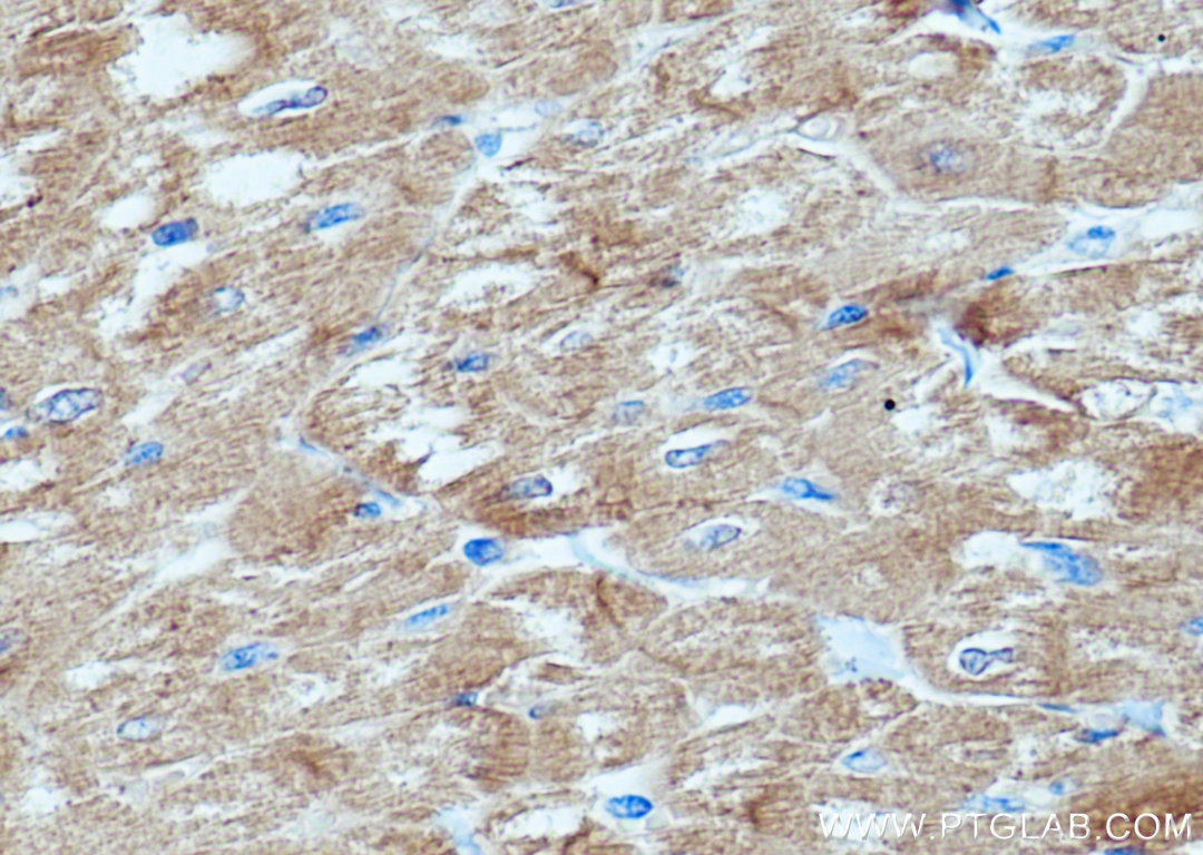 IHC staining of human heart using 16582-1-AP