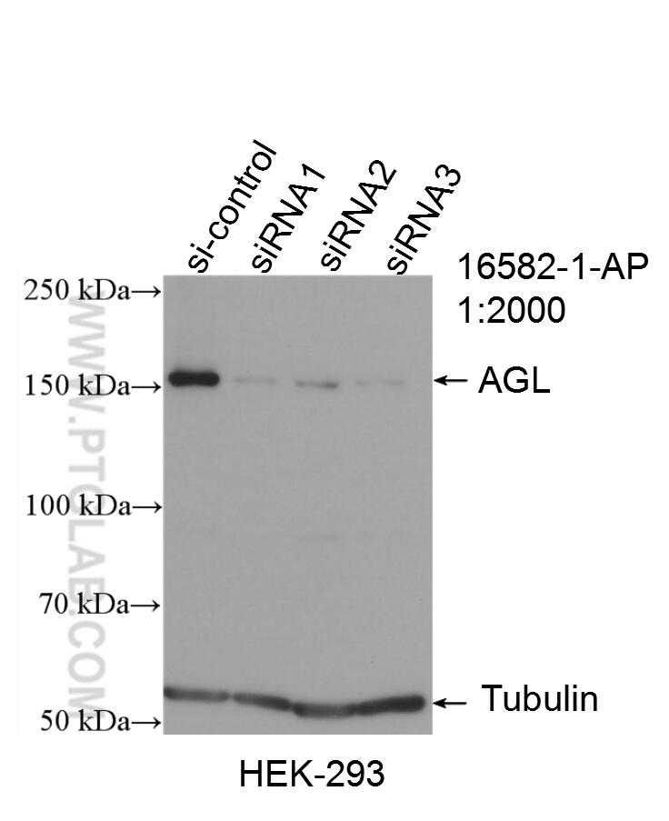 Western Blot (WB) analysis of HEK-293 cells using AGL Polyclonal antibody (16582-1-AP)