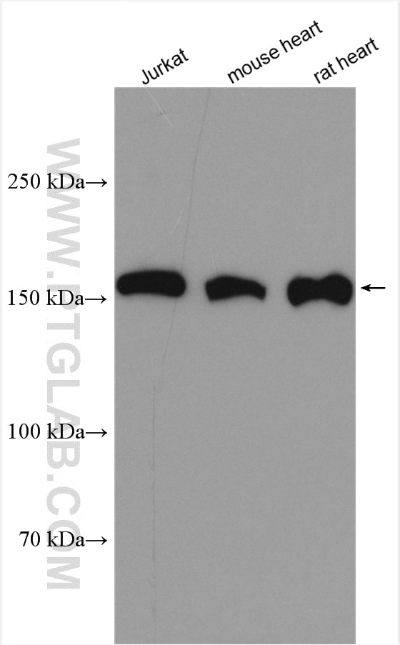 Western Blot (WB) analysis of various lysates using AGL Polyclonal antibody (16582-1-AP)