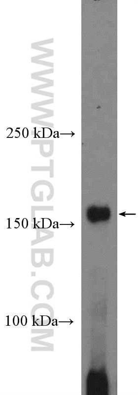 Western Blot (WB) analysis of mouse heart tissue using AGL Polyclonal antibody (16582-1-AP)