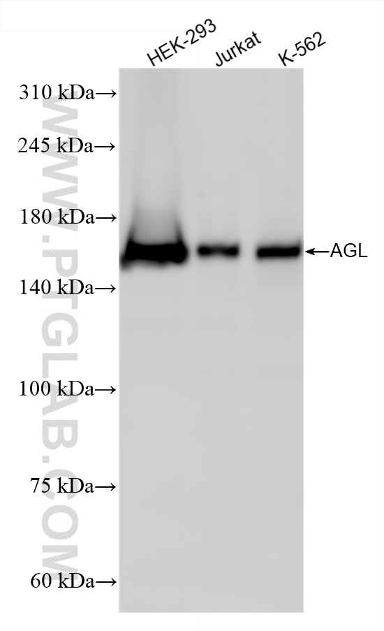 Western Blot (WB) analysis of various lysates using AGL Recombinant antibody (86187-1-RR)